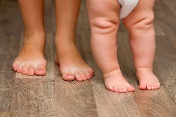 Valgus deformation in children