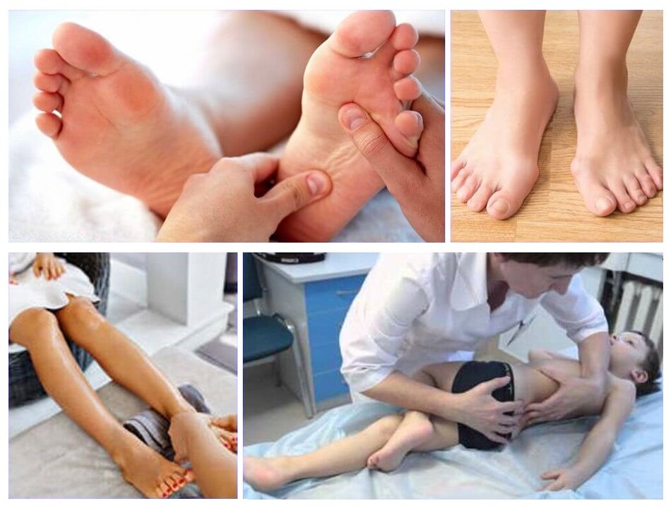 Valgus deformation in the treatment of children