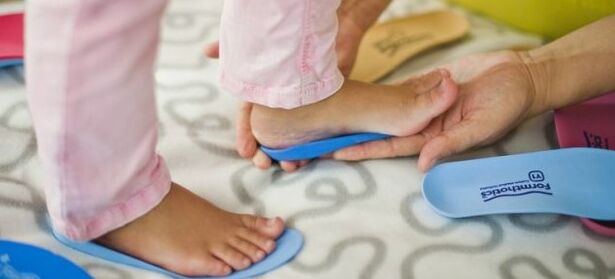 Insoles with the deformation of the skirt in children