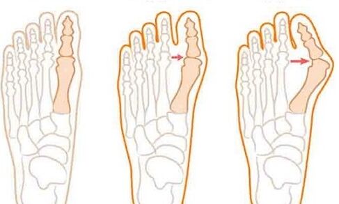 The development of the foot